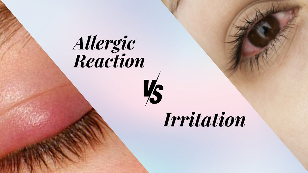 Allergic Reactions vs. Irritations in Eyelash Extensions