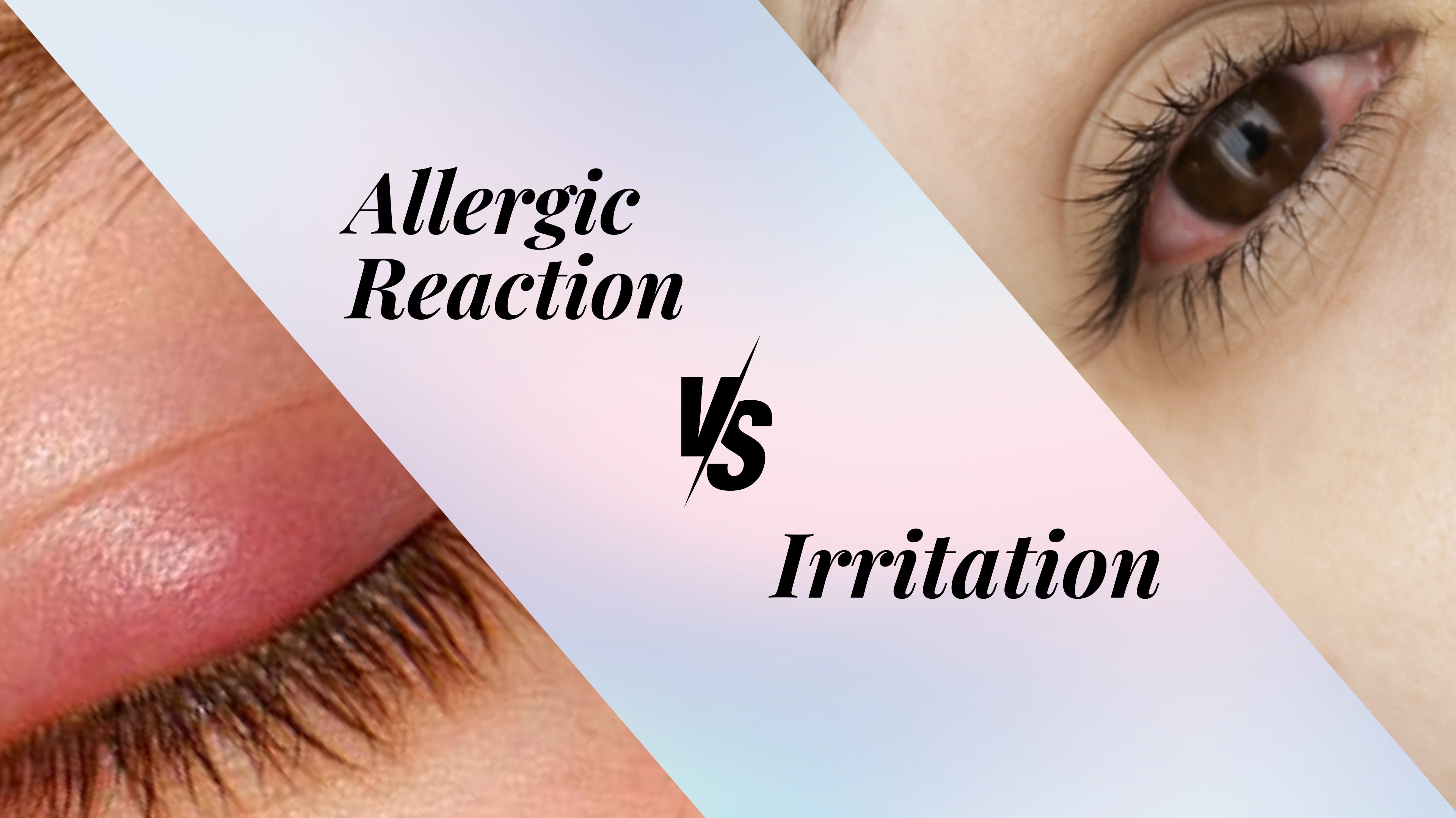 Allergic Reactions vs. Irritations in Eyelash Extensions